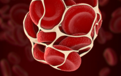 Trombosis Venosa Profunda