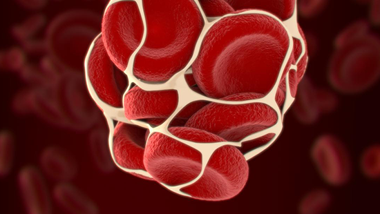 Trombosis Venosa Profunda