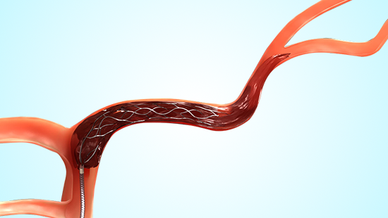 Joint ache, female person with leg stretching